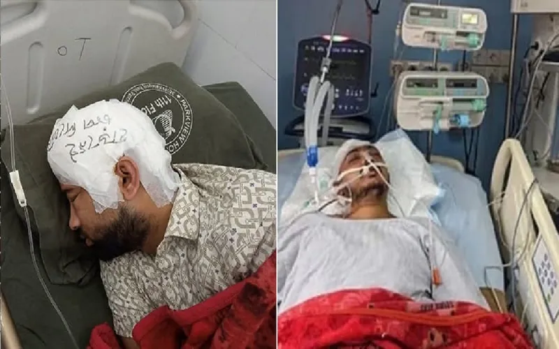 চট্টগ্রাম বিশ্ববিদ্যালয়ে সংঘর্ষ: মাথার খুলি ফ্রিজে, জ্ঞান ফেরেনি সায়েমের