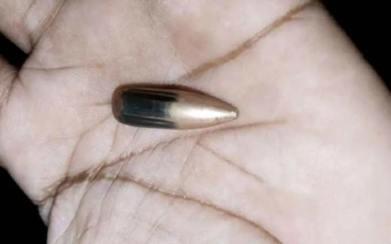 মিয়ানমার থেকে ছোড়া গুলিতে টেকনাফে নারী আহত